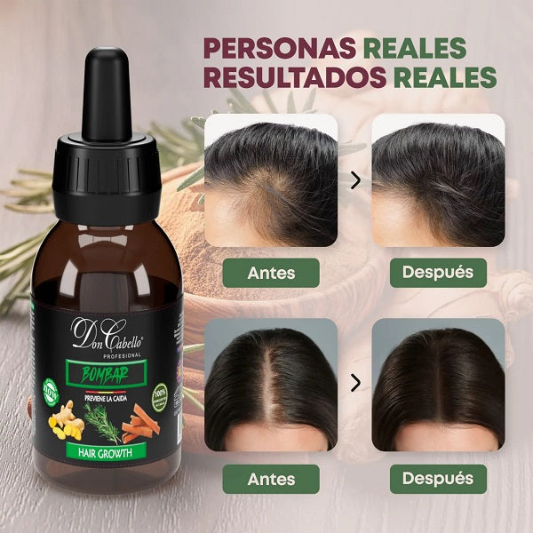LOCIÓN CAPILAR - FORTALECE CABELLO Y ESTIMULA CRECIMIENTO